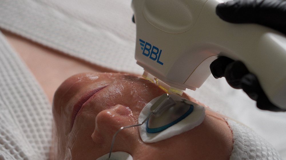 Фотолечение BBL HERO