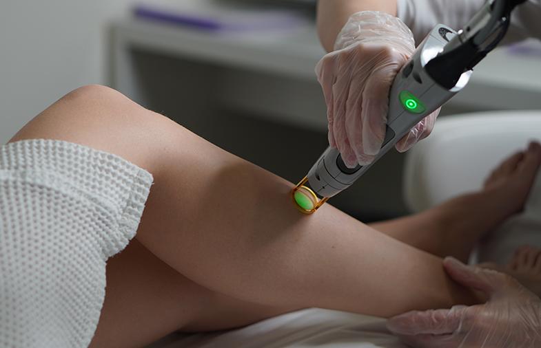 Эпиляция на александритовом лазере CANDELA