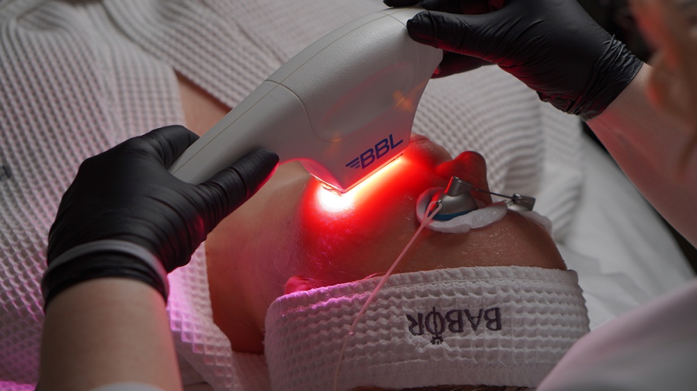 Инфракрасный термолифтинг SkinTyte II (СкинТайт)